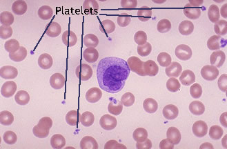 media/example_platelets.png